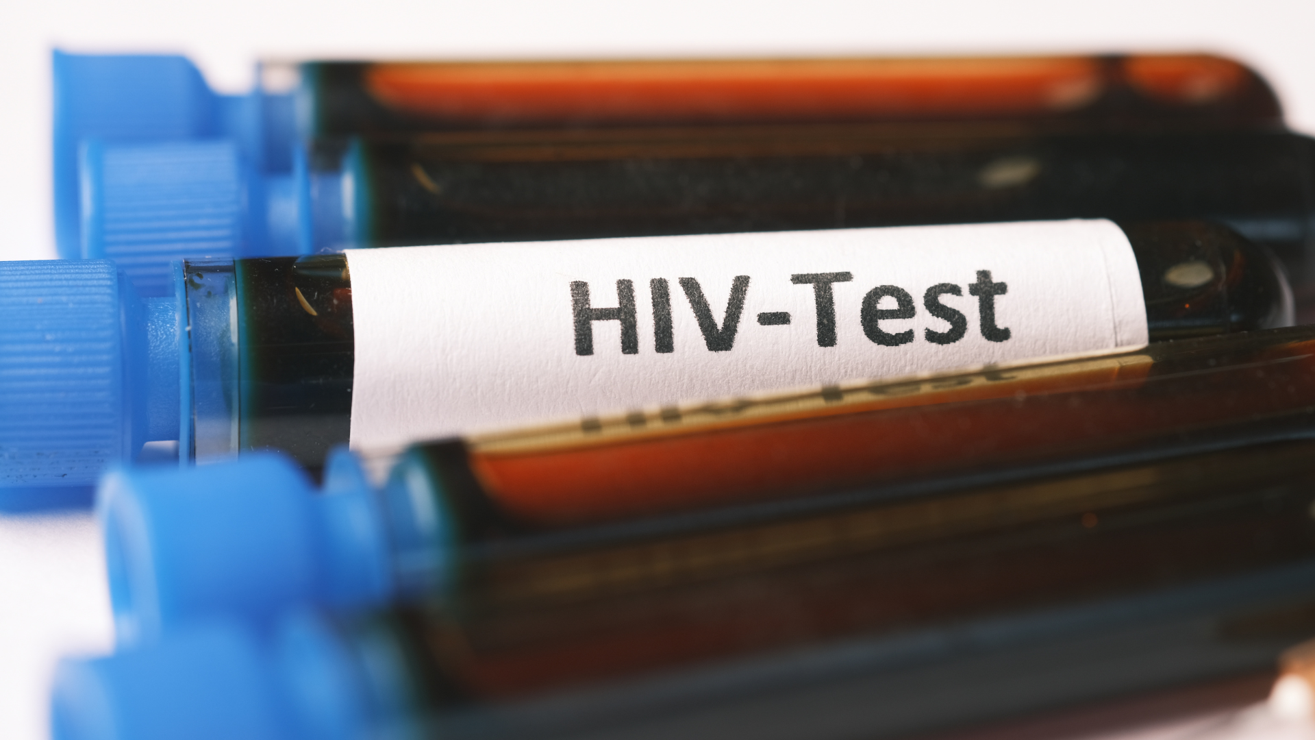 Que Test HIV: Cách sử dụng, độ chính xác và gợi ý sản phẩm test nhanh uy tín